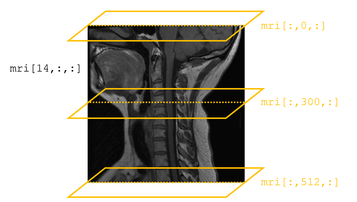 mri cross sections